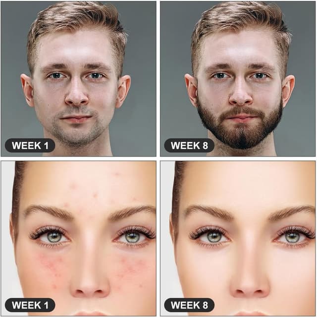 Detalle 1 de LOPHE Derma Roller 2,5 mm (rouleau à micro-aiguilles) pour visage, corps et yeux