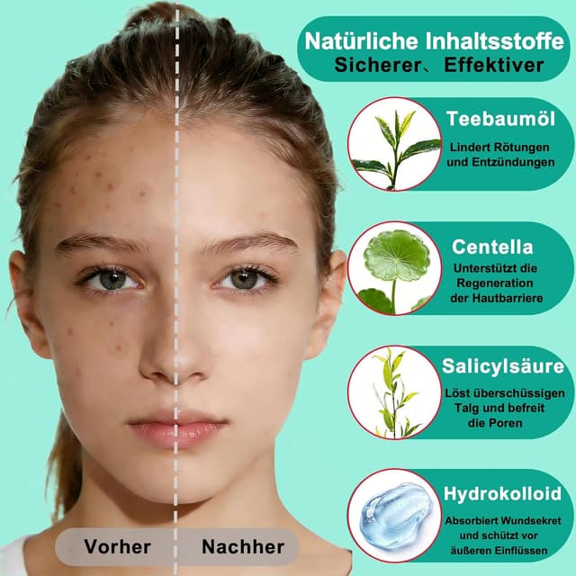 Detalle de Zosilong 720 unsichtbare Pickel-Patches – hautfreundliche Pimple Patches für Tag & Nacht