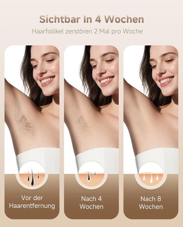 Thumbnail 5 de Bellizy 21J Epilatore IPL 21J per corpo e viso