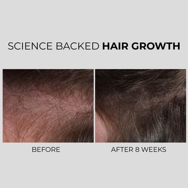 Detalle de Nanogen Hair Growth Factor Treatment – sérum pour la pousse des cheveux à l’extrait de pea sprout, écorce et peptides (30 ml)