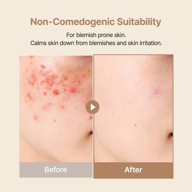 Detalle 2 de Purito Oat In Calming Gel Cream 100 ml