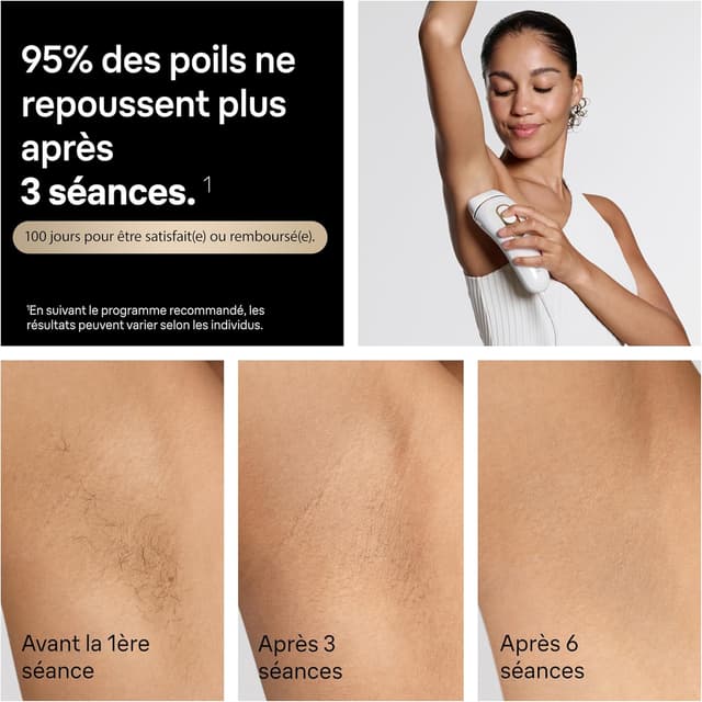 Detalle de Braun Silk·expert Pro 5 (PL5311) : épilateur IPL Lumiere Pulsee smart pour réduire durablement les poils à domicile