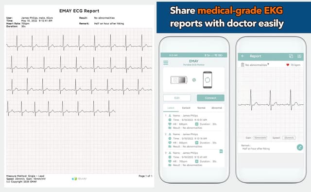 Thumbnail 3 de EMAY Portable ECG/EKG Monitor 1‑lead