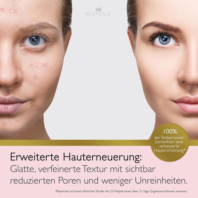 Detalle 2 de Revitale Advanced Salicylic Acid Cream für Gesicht & Körper (80 g) – gegen raue, holprige und zu Unreinheiten neigende Haut