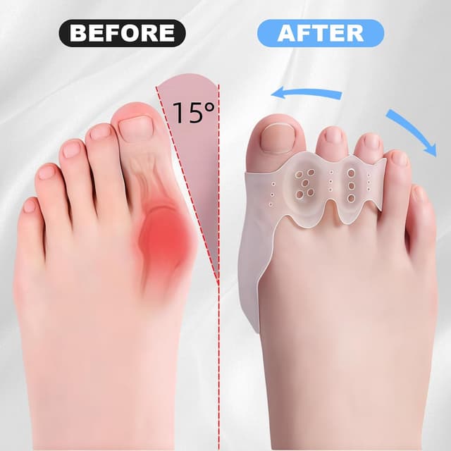 Thumbnail 4 de Separador de dedos de silicona 3 piezas