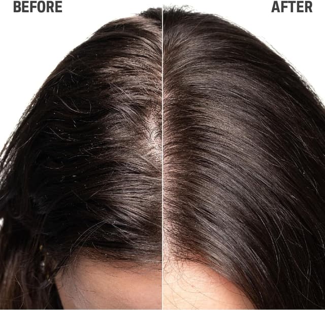 Detalle de Goldwell Dualsenses Scalp Specialist Sensitive Foam Shampoo (pH neutral, fragrance-free) 250ml