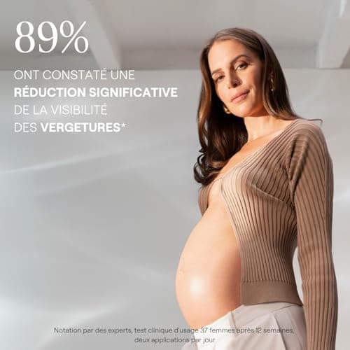 Thumbnail 1 de Weleda Bálsamo de masaje 150 ml para estrías 🤰