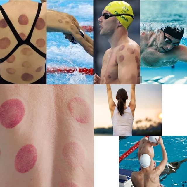 Thumbnail 5 de 24 Stück Schröpfgläser mit Vakuumpumpe