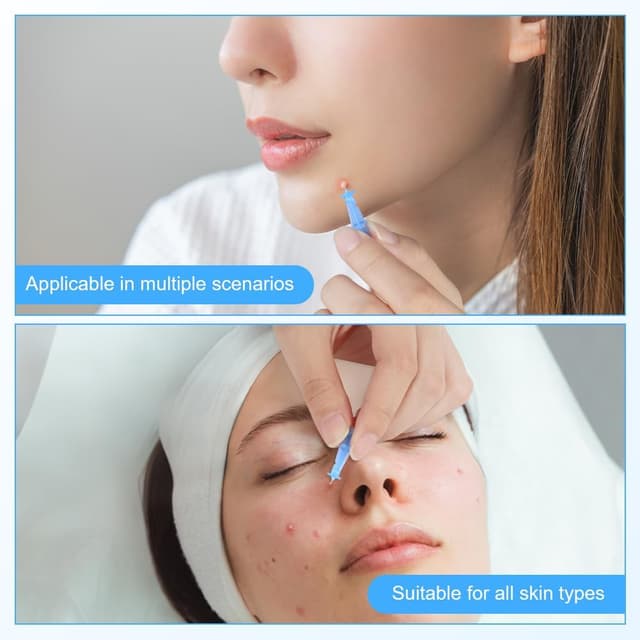 Thumbnail 6 de LOPHE Extracteur de points noirs avec 100 aiguilles jetables et 2 outils 2-en-1