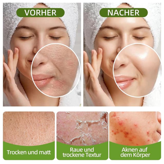 Thumbnail 4 de Sheabutter Bio Hautpflege 110 g