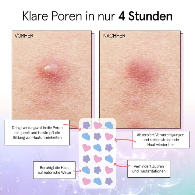 Thumbnail 2 de Grace & Stella Pickel Patch 36 Stück