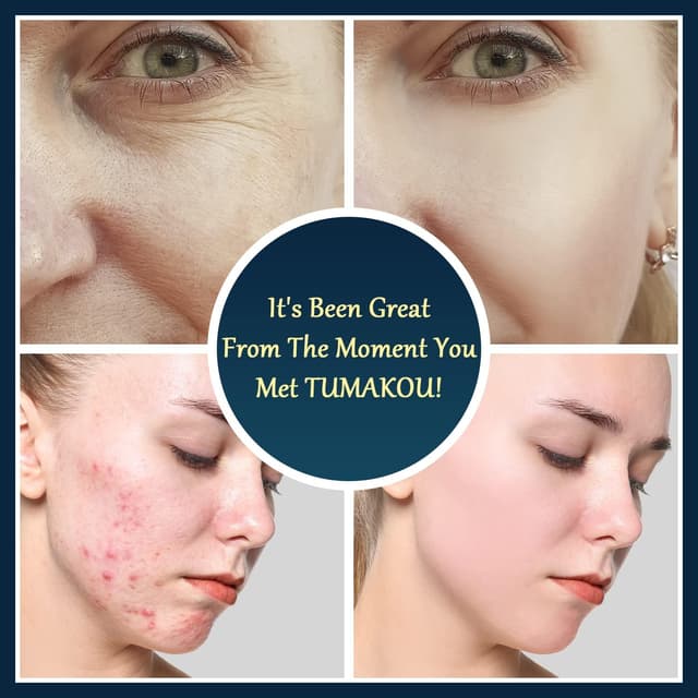 Thumbnail 4 de TUMAKOU Portatile Alta Frequenza Viso 6 Elettrodi