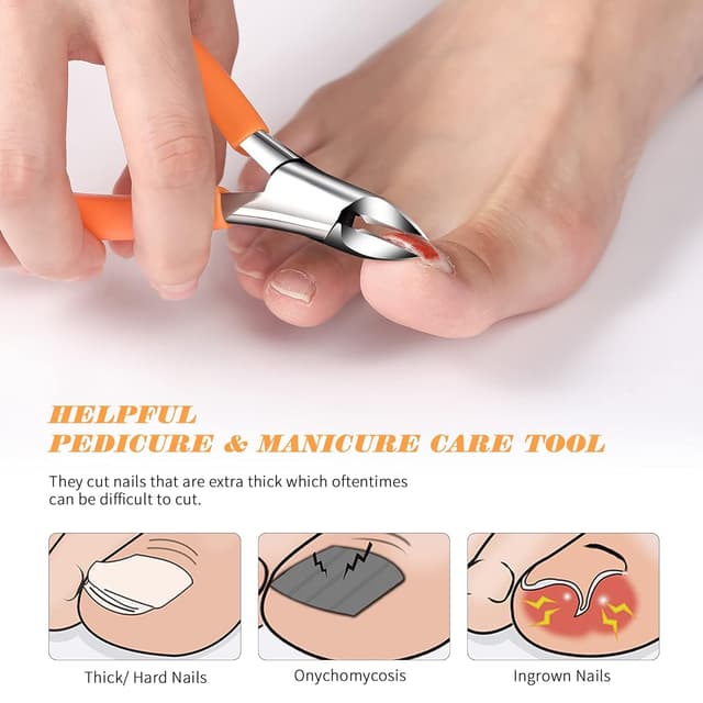 Detalle de FVION Profi-Nagelzange für Fußnägel aus Edelstahl (orange) – für dicke & eingewachsene Nägel