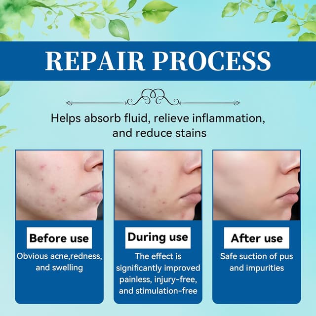 Thumbnail 4 de 397 Stück Bunte Sterne Pickelpflaster 🩹