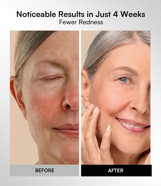 Thumbnail 4 de INIA Red Light Therapy Mask 2600mAh 🧖♀