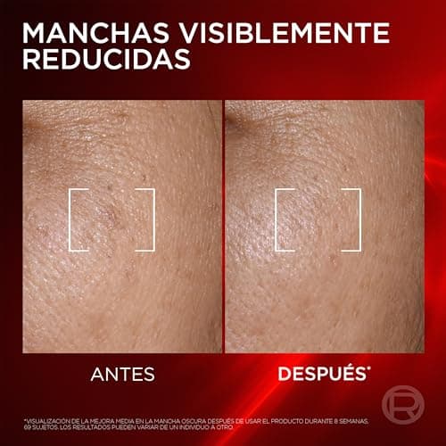 Detalle 2 de L’Oréal Paris Revitalift Laser Triple Serum con Melasyl, Vitamina C y Niacinamida (50 ml)