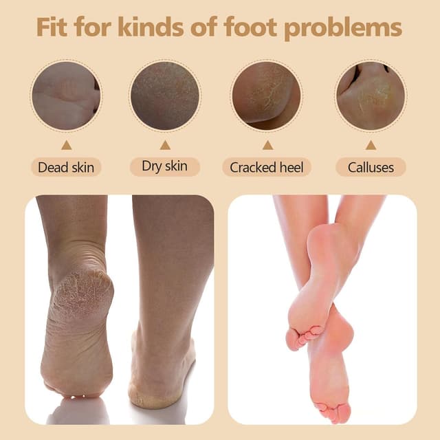 Detalle de Electric foot file for calluses, 2 speeds