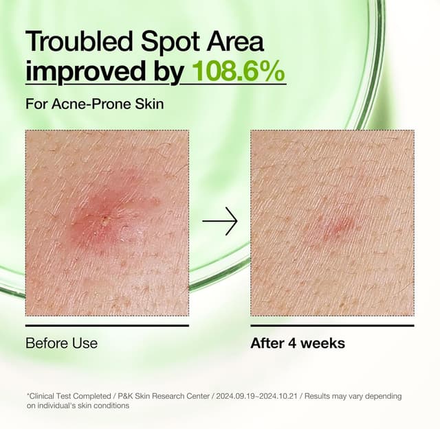 Thumbnail 3 de Anua Azelaic 10 Hyaluron Serum