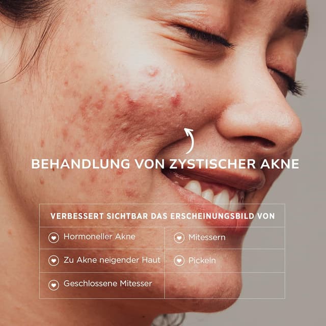 Detalle 2 de BellamiLuxx Akne Creme Hautpflege