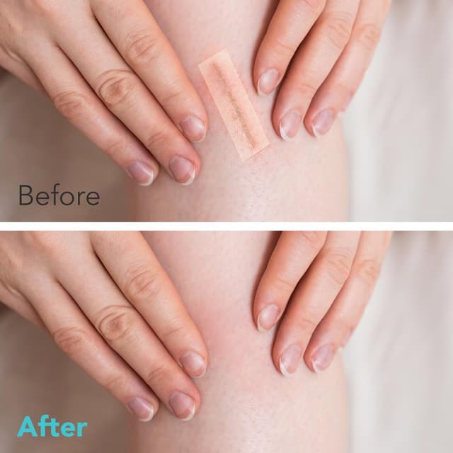 Thumbnail 5 de Hydrocolloid Roll 2in x 12ft wound dressing 🩹