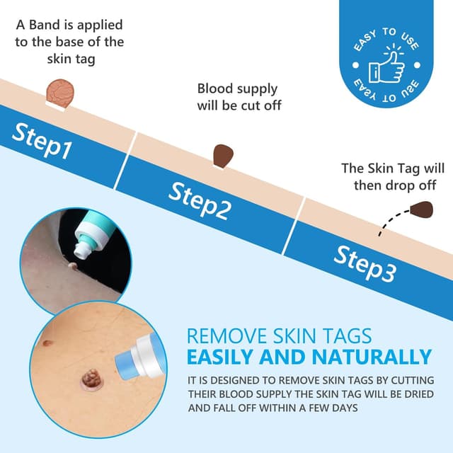 Thumbnail 5 de Skin Tag Removal 2‑in‑1 Auto Kit