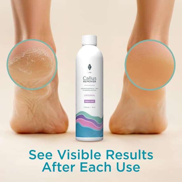 Detalle 2 de Lee Beauty 8oz Gel Callus Remover for Feet 🦶