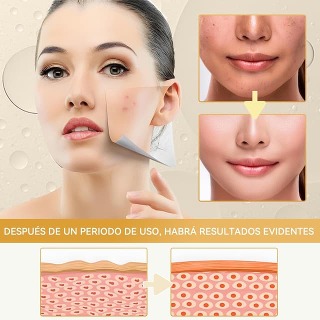 Thumbnail 4 de prowithlin Ácido Glicólico 7% tónico facial