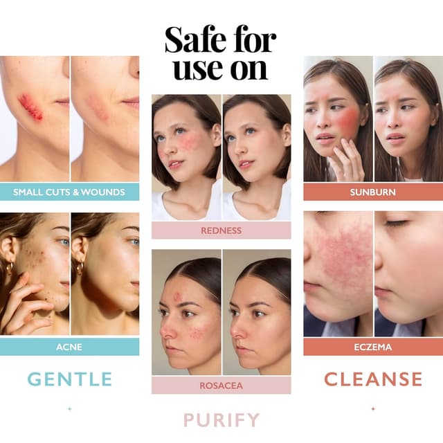 Detalle de Aquia Hypochlorous Acid Spray for Face and Skin (8oz) — Antimicrobial Facial Cleanser & Face Mist