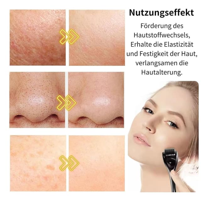 Detalle 2 de Derma-Roller 0,5mm Microneedling Roller 540 Nadeln