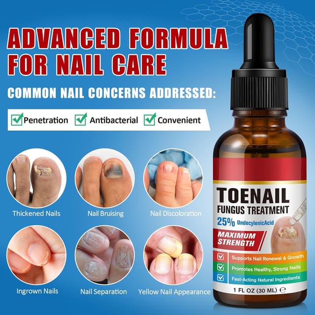 Thumbnail 2 de Tratamiento para Hongos en las Uñas 30 ml