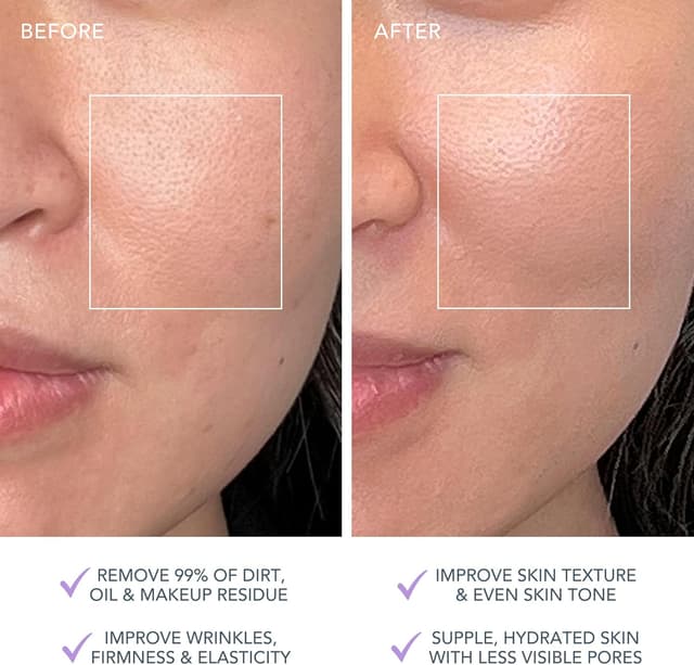 Detalle 1 de FOREO LUNA 4 Plus Gesichtsbürste mit 16 Intensitäten