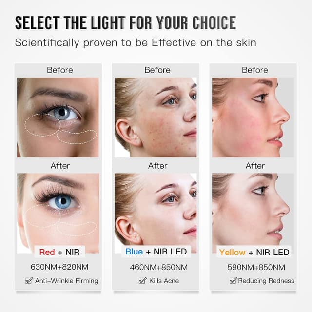 Detalle 2 de IBORRIA Máscara LED de Terapia Lumínica Facial 🌟