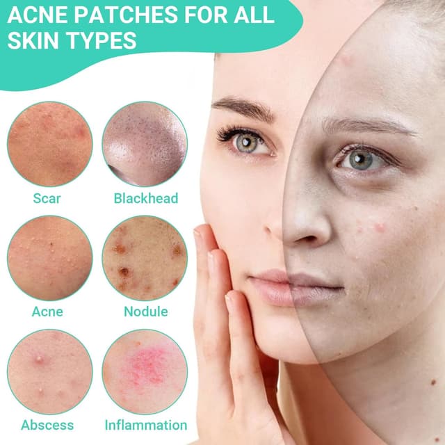 Thumbnail 6 de Patch Brufoli Idrocolloidali invisibili giorno e notte con Tea Tree Oil e Acido Salicilico, 200 cerotti