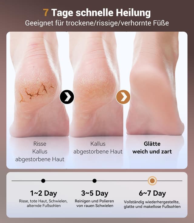 Detalle 2 de LOZLTX 2025 Hornhautentferner 130g