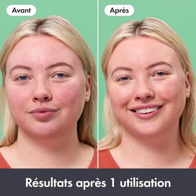 Thumbnail 2 de Hero Cosmetics Rescue Balm 15 mL, baume correcteur