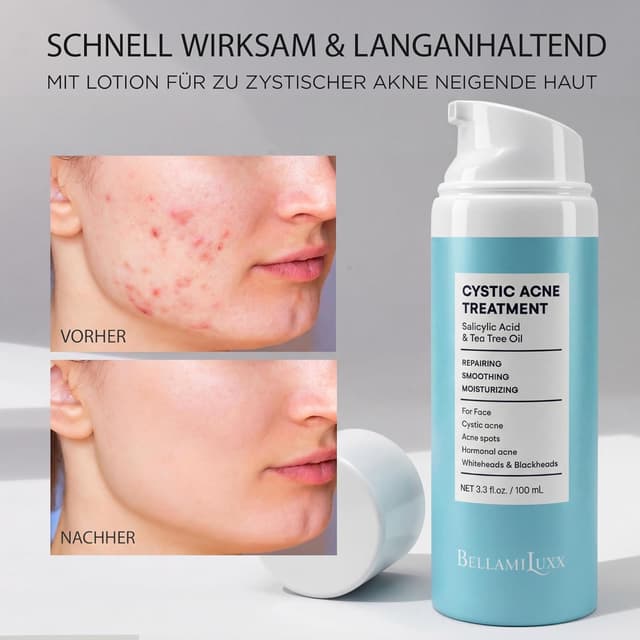 Detalle de BellamiLuxx Akne Creme Hautpflege