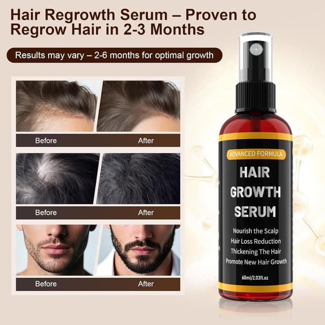 Detalle 2 de Haarwachstum Serum Spray 60ml für Männer/Frauen