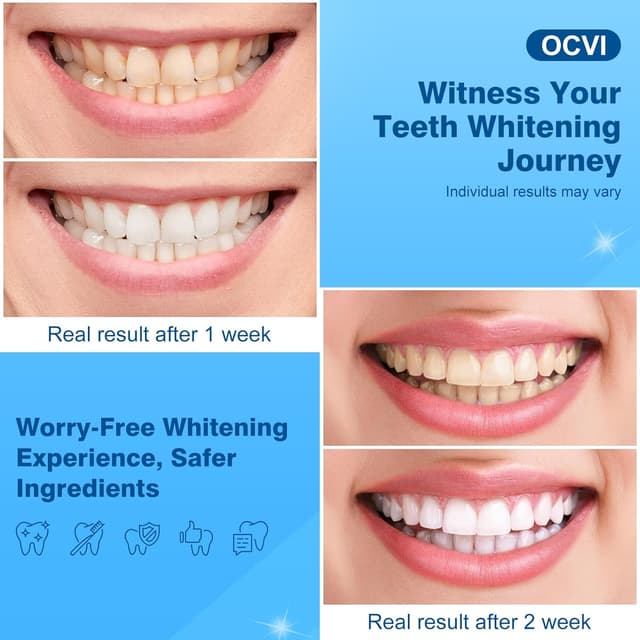 Thumbnail 5 de Teeth Whitening Strips 14 Treatments