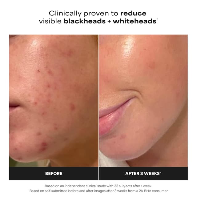 Detalle 2 de Paula's Choice Skin Perfecting BHA 2% Salicylic Exfoliant