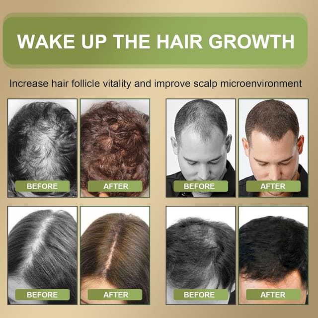 Detalle 2 de Aceite de Romero 60ml para cabello