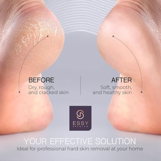 Detalle de Essy Electric Foot File Hard Skin Remover with 5 Replacement Rollers (Purple)