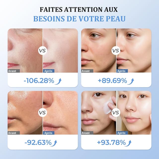 Detalle 2 de Oranmagic Appareil Visage radiofréquence 7 heures 💆