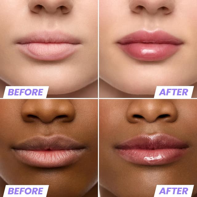 Detalle de Wonderskin Lip Oil Rehab Serum 1.0 oz