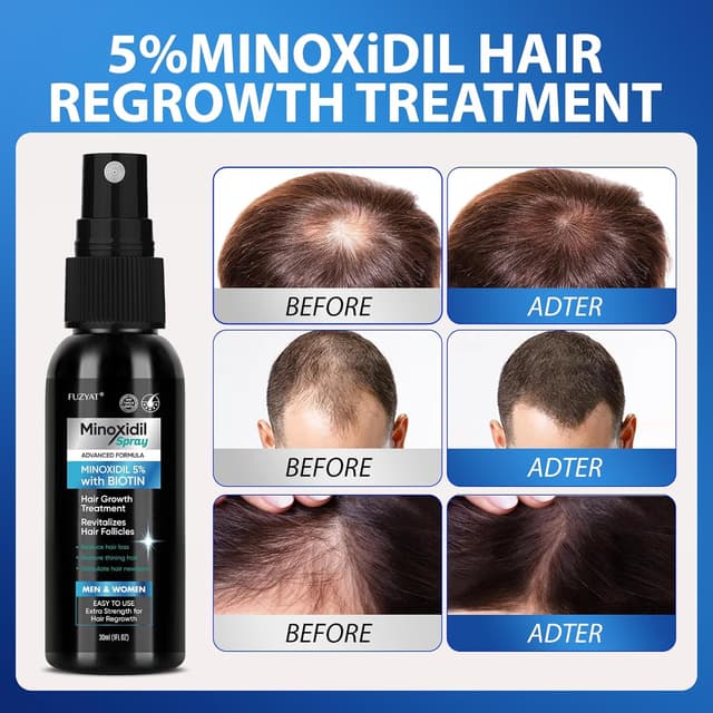Detalle de 5% Minoxidil Hair Growth Spray (Men & Women) with Biotin, 60ml