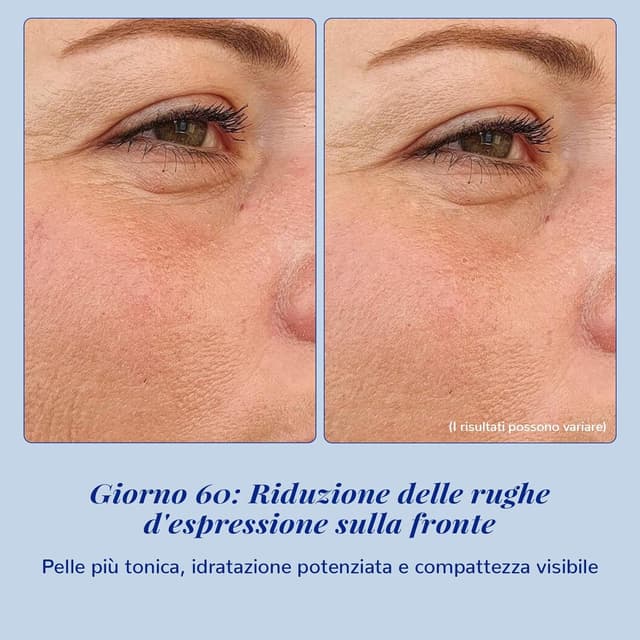 Detalle 2 de ANAiRUi Matrixyl 3000 siero viso 30 ml