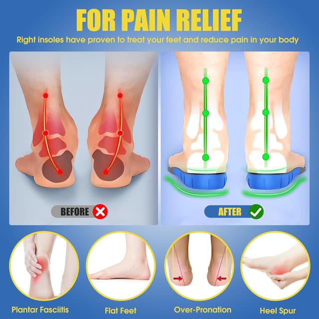 Detalle de Cilnos semelles orthopédiques pour fasciite plantaire, pieds plats et épine calcanéenne (homme & femme) – XL