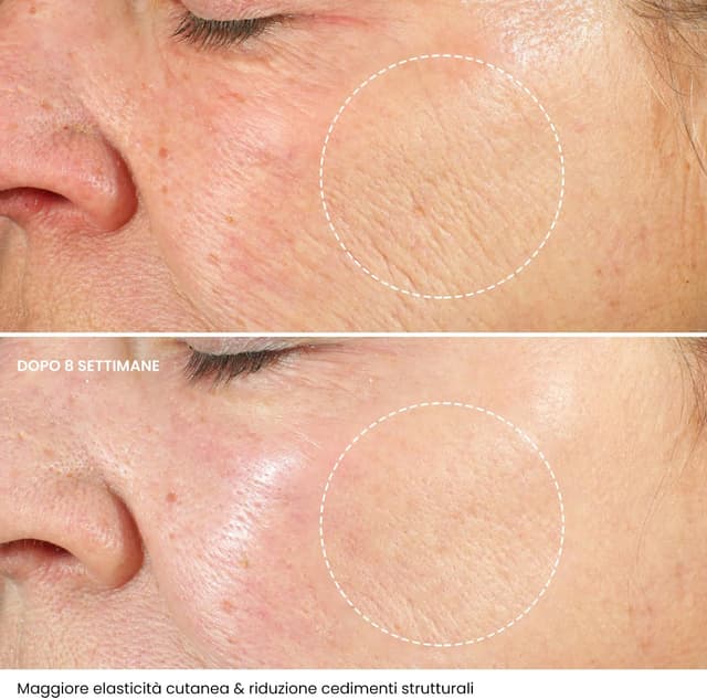 Thumbnail 4 de Crema Viso Antirughe 50ml con Acido Ialuronico