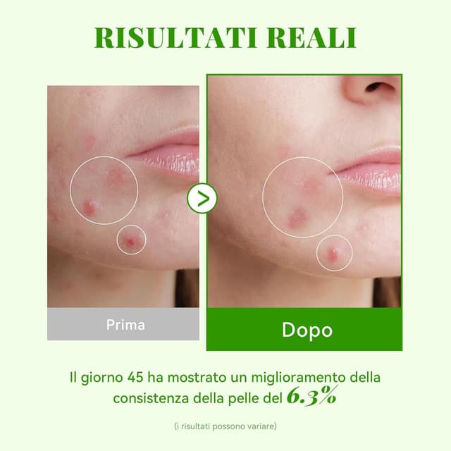 Thumbnail 6 de ANAiRUi Exosome Cica Siero 30 ml per pelli sensibili