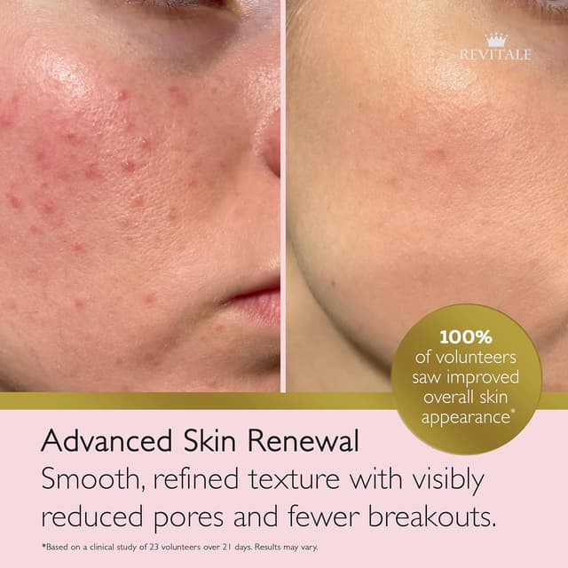 Thumbnail 1 de Revitale Crema avanzata 80 g per viso e corpo