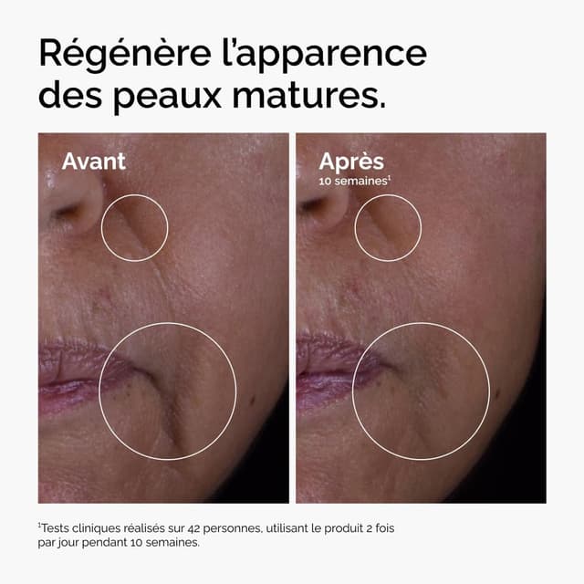 Detalle de The Ordinary Solution GF 15% (30 ml) – sérum facteurs de croissance pour visage et cou